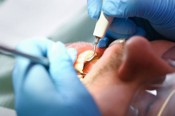 Best Dental Emergency Near Me  in Bidwell, OH