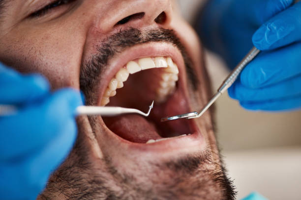 Best Emergency Tooth Extraction  in Bidwell, OH