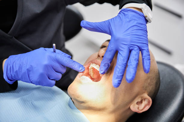 Best Emergency Gum Pain Relief  in Bidwell, OH