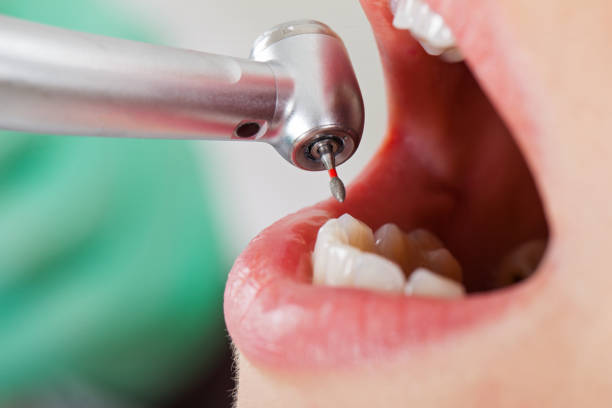 Best Tooth Infection Emergency Dentist  in Bidwell, OH